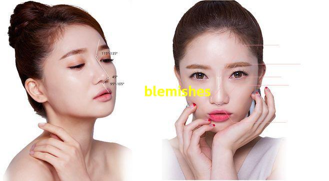 blemishes