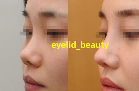 eyelid beauty