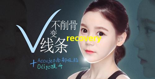 recovery