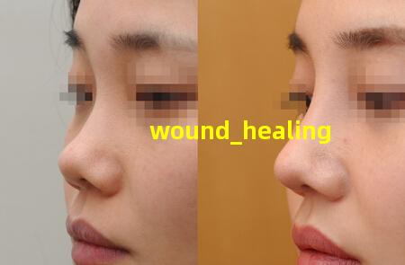 wound healing